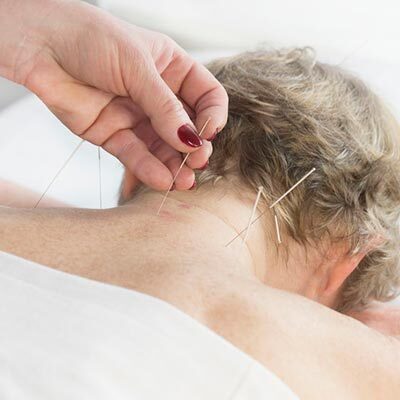 Arizzi Chiropractic Offers Acupuncture in Middleton MA